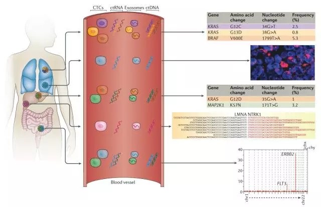 Nature Reviews：整合的液體活檢方案用于管理癌癥&mdash;&mdash;ctDNA、CTCs和exosomes